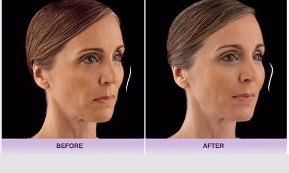 blog_juvedermvoluma_ba