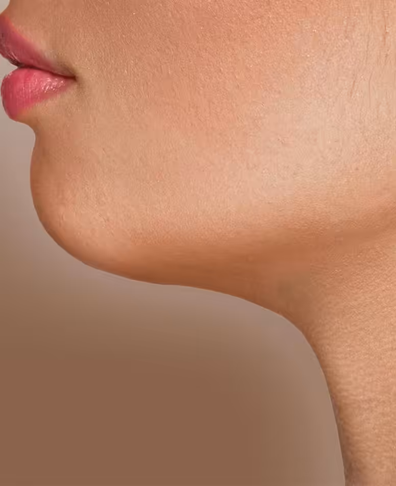 ipognathismos_header